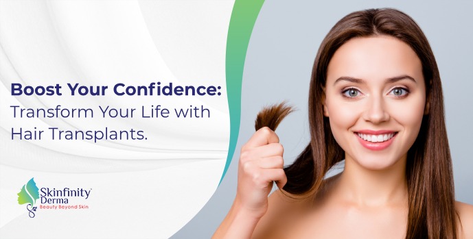  Life with Hair Transplants