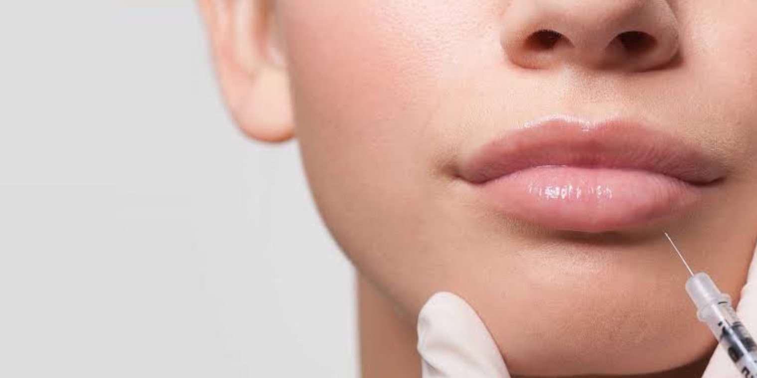 Lip Fillers