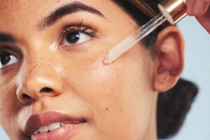 retinol for acne