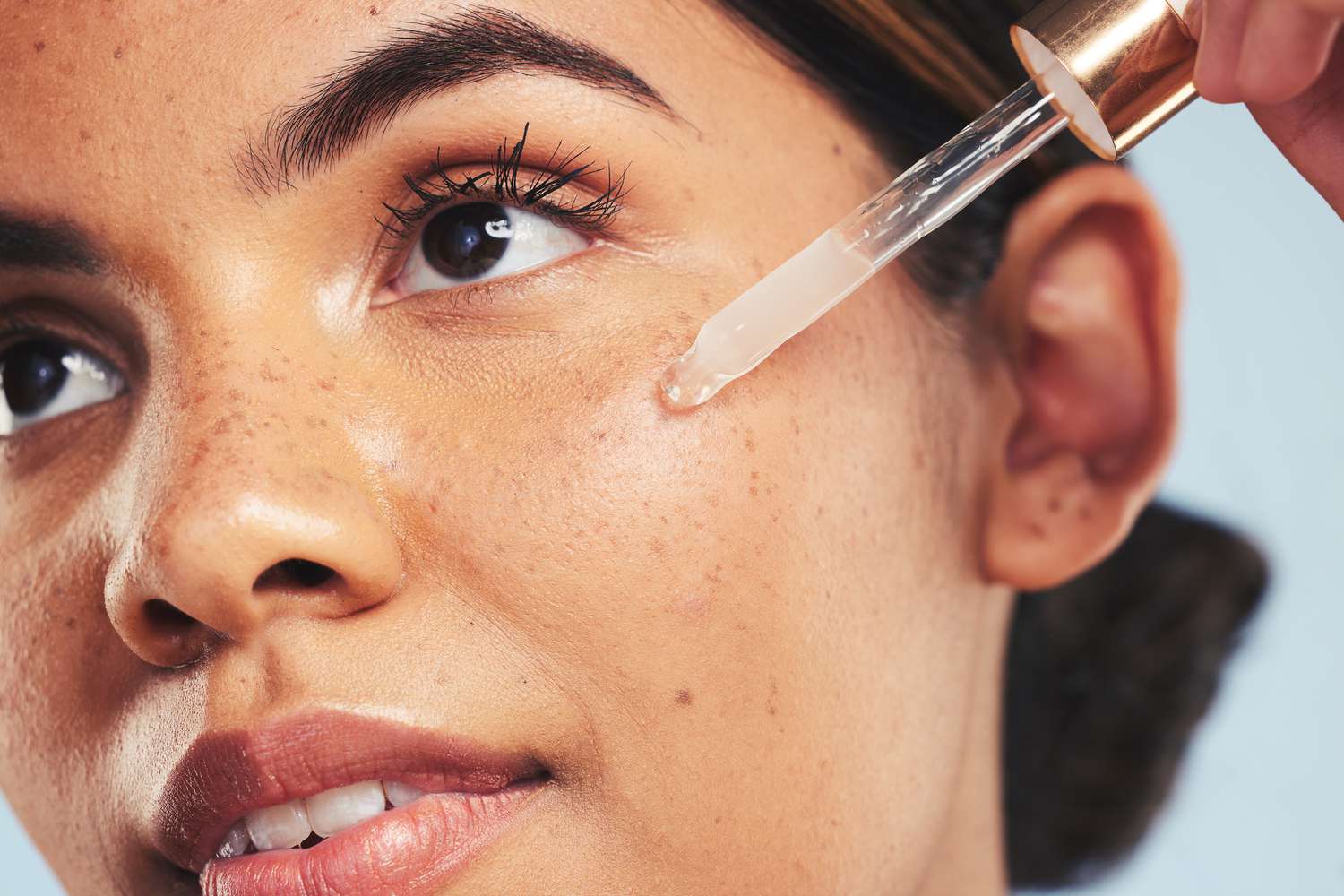 retinol for acne