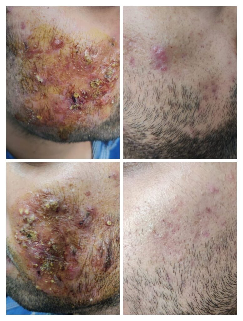 trusted dermatologist Rohini