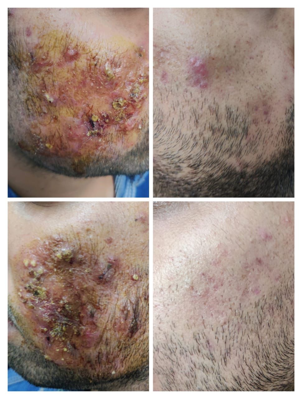 trusted dermatologist Rohini