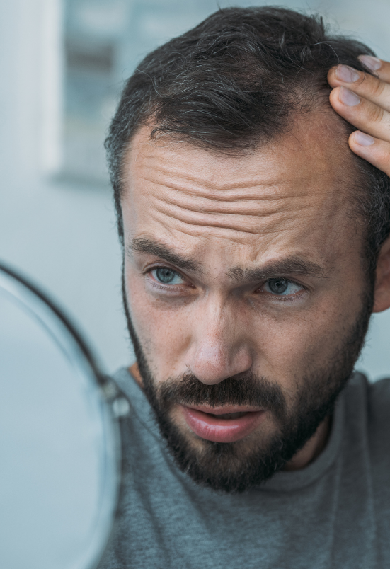 hair fall treatment Rohini