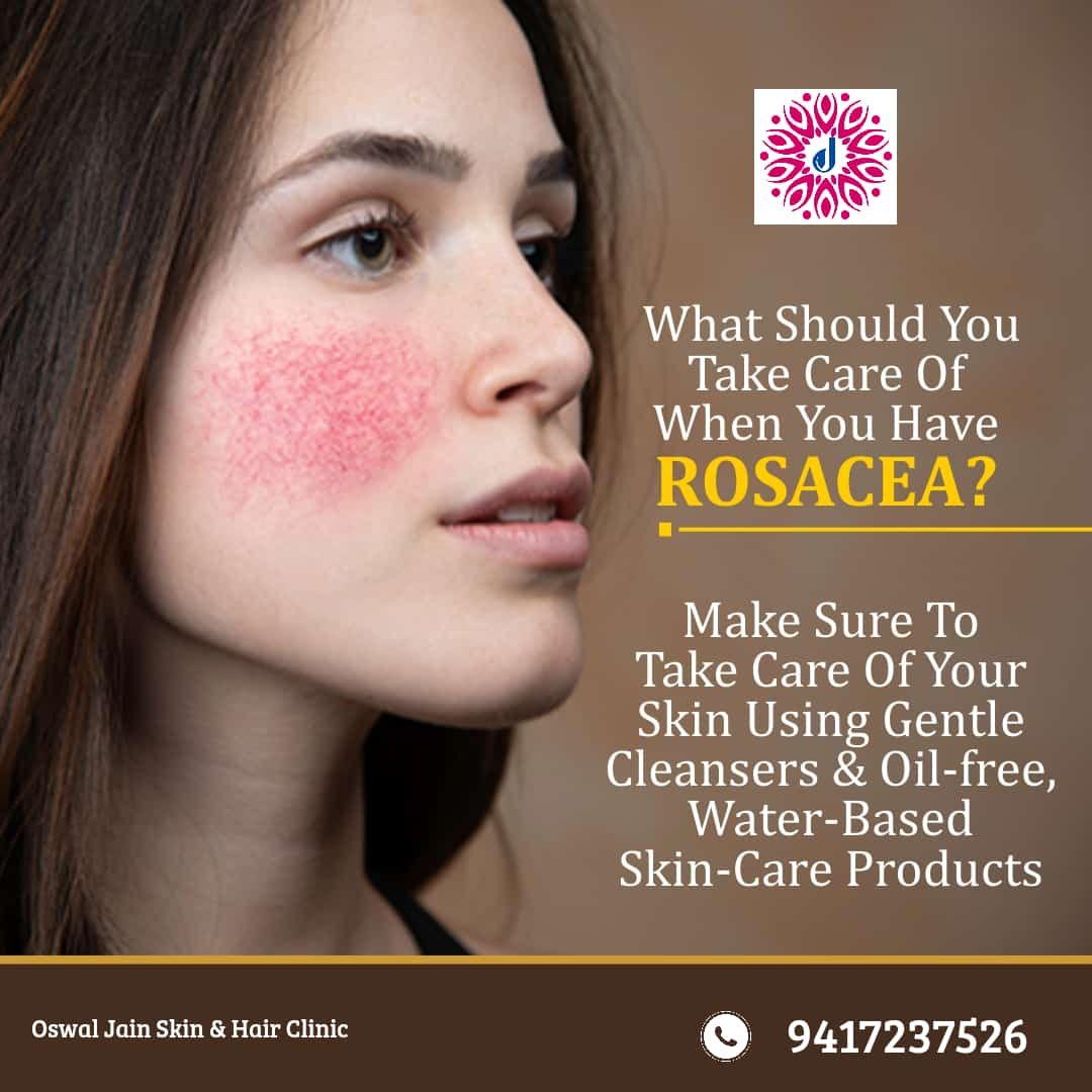 trusted dermatologist in Rohini