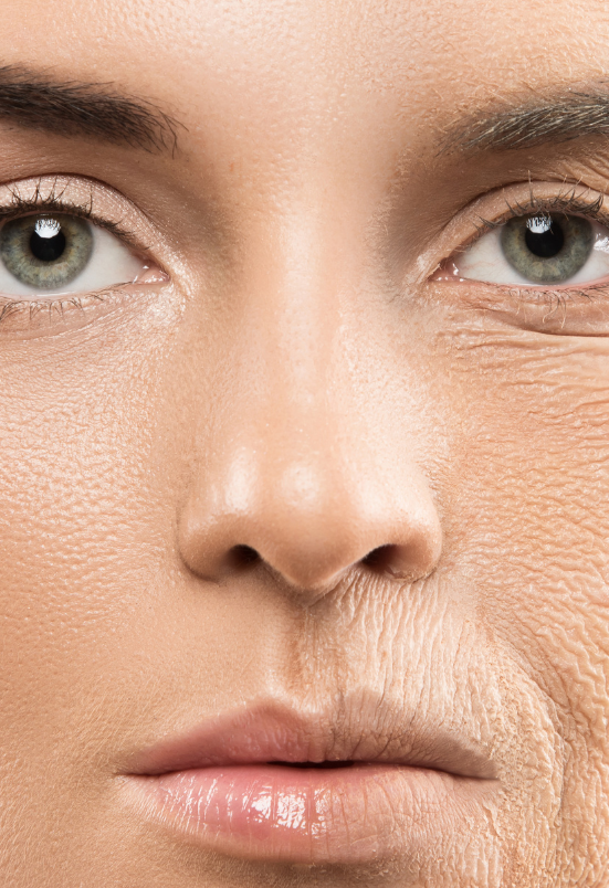 anti ageing treatment in Rohini Delhi