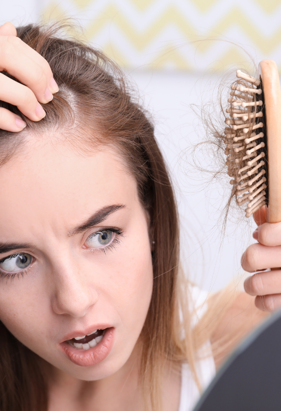 hair loss treatment in Rohini Delhi