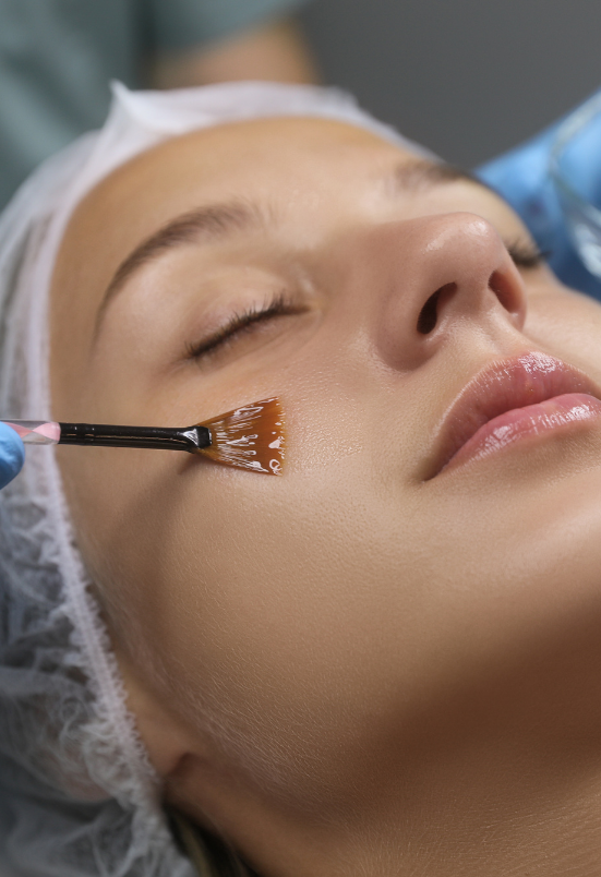 This image is featured in the blog "Transform Your Skin with Advanced Chemical Peel Treatment in Rohini." The blog explains the benefits of chemical peel treatment, common skin concerns it can help improve, and the importance of personalized care from an experienced dermatologist. Dr. Varun Jain provides customized skin treatments at Oswal Jain Skin & Hair Clinic in Rohini, Delhi. Visit https://www.oswaljainskinclinic.com/ to learn more or book an appointment.