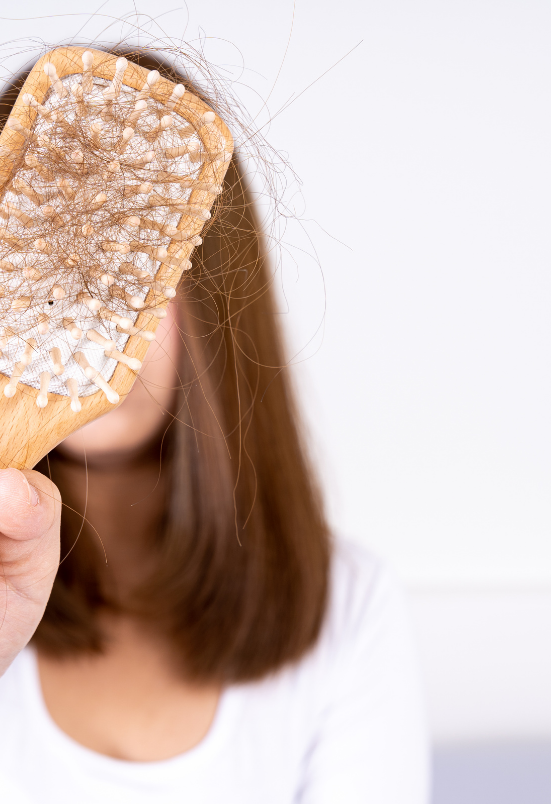 hair fall treatment in Rohini Delhi