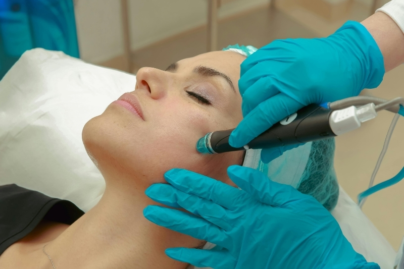 melasma treatment Rohini