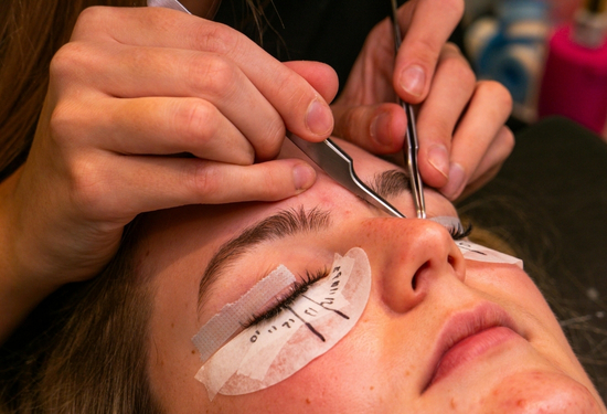 dark circle treatment Rohini