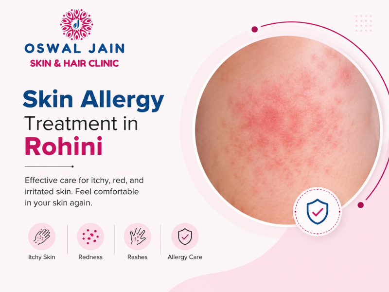 Best Skin Allergy Treatment in Rohini Delhi by Dr. Varun Jain at Oswal Jain Skin & Hair Clinic