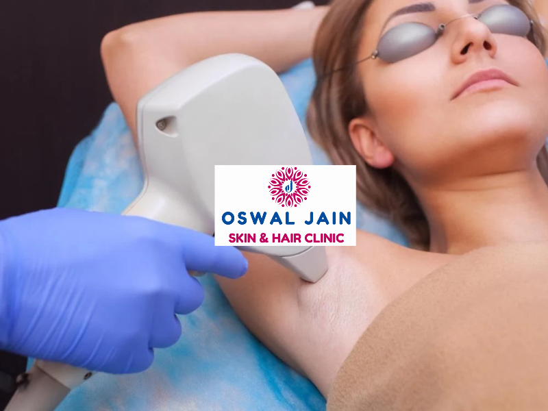Laser hair removal treatment and expected results