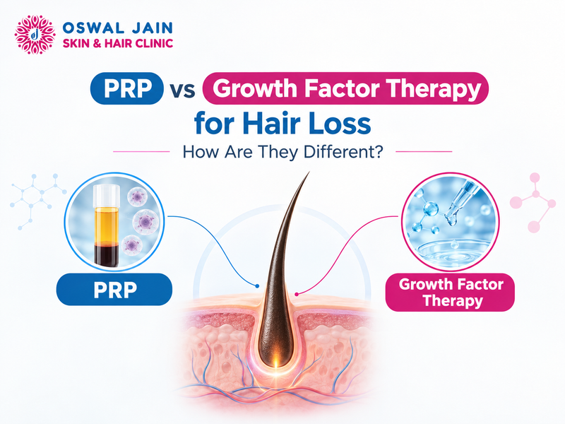 PRP vs growth factor therapy for hair loss